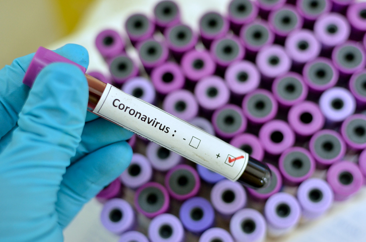 Coronavirus :  1.527 cas au Maroc, 3 nouveaux décès